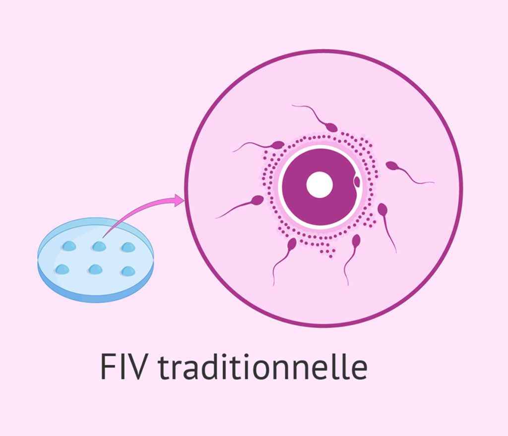 fiv